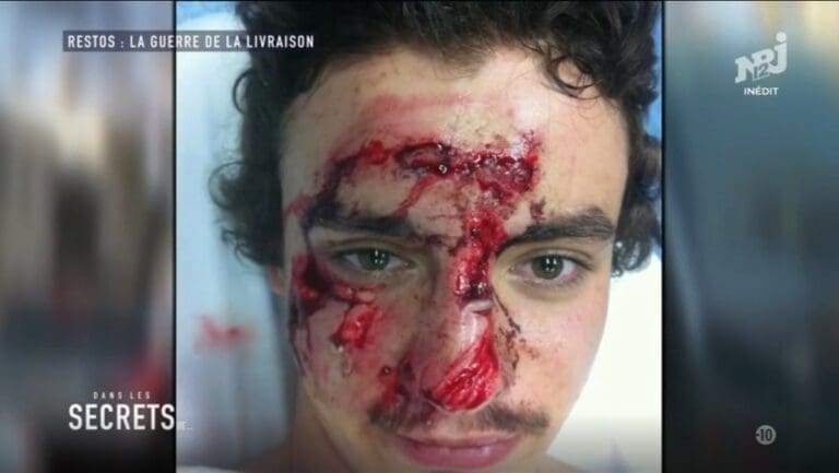 Regardez pourquoi ce jeune homme a le visage en sang !