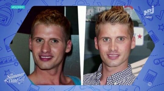 Combien Benoit Dubois a-t-il dépensé dans la chirurgie esthétique ?