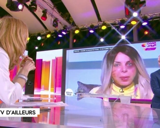 Une présentatrice égyptienne, violentée par son mari …