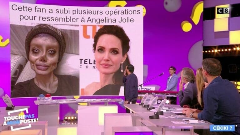 Une chirurgie esthétique finit mal !