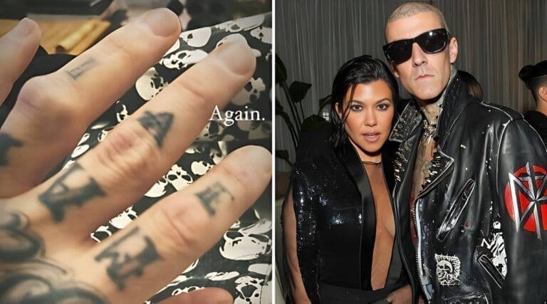 Kourtney Kardashian s’inquiète pour Travis Barker, il montre sa blessure effrayante !