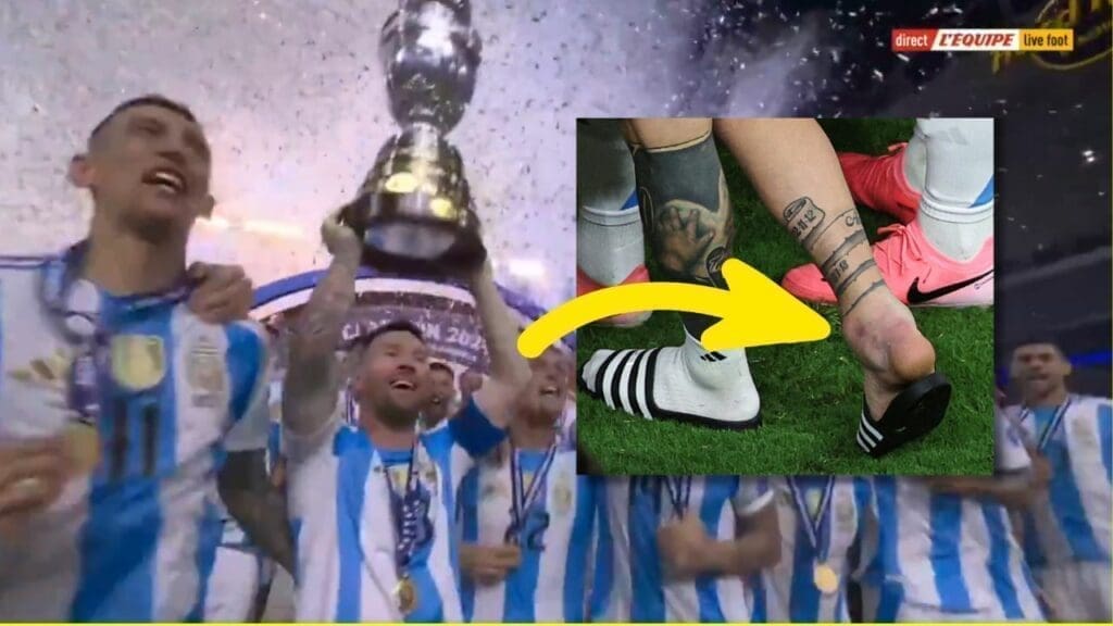Messi finale Copa America blessure cheville