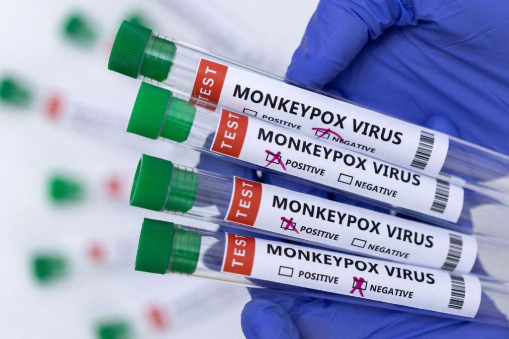 Illustration shows test tubes labelled « Monkeypox virus positive and negative