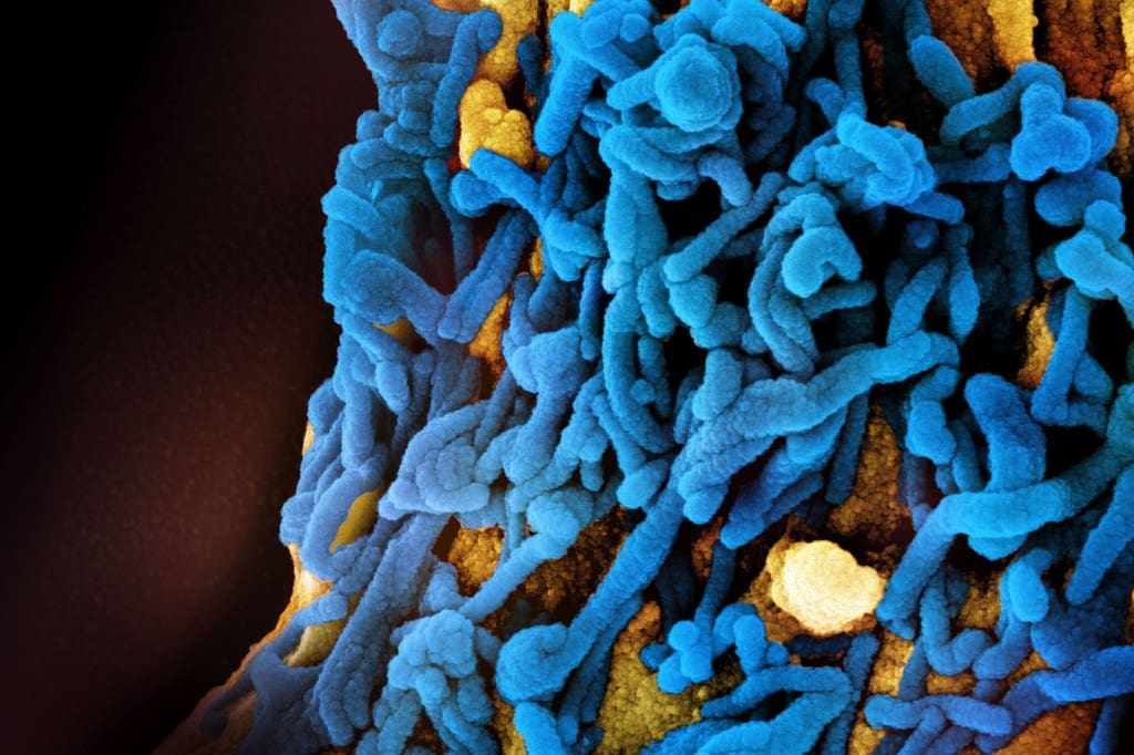 Le virus de Marburg réapparaît et se propage violemment en Tanzanie