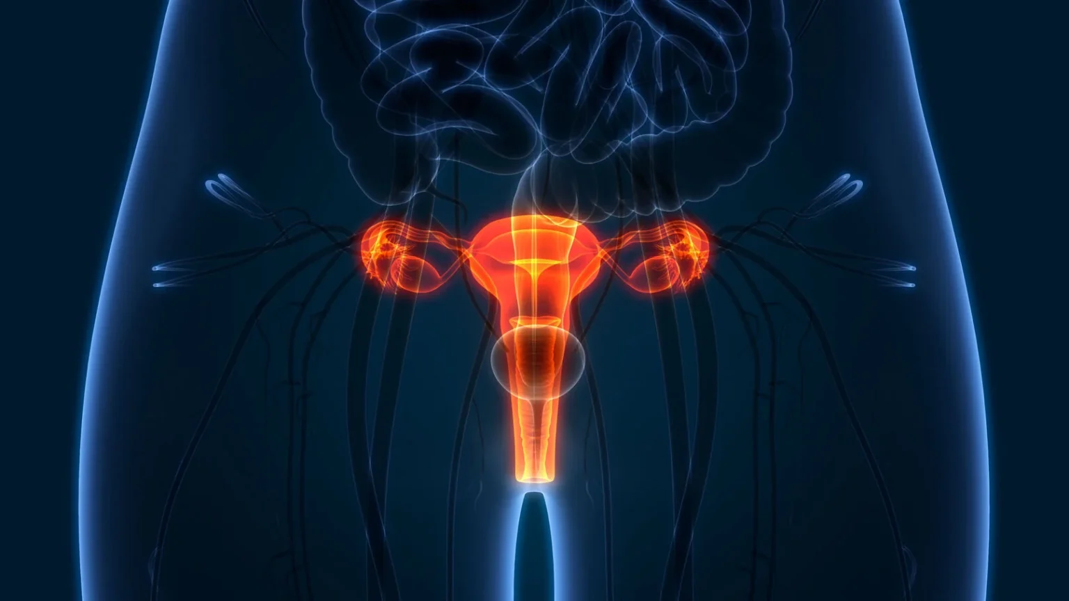 canceruterus