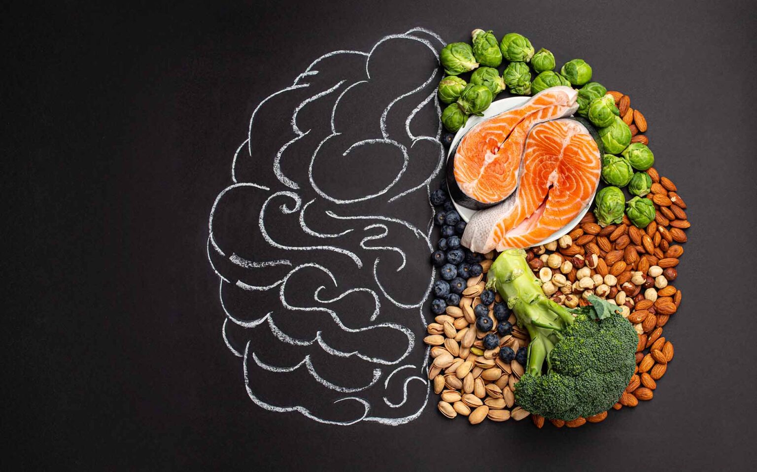Conseils pour un régime alimentaire favorable à la santé cérébrale