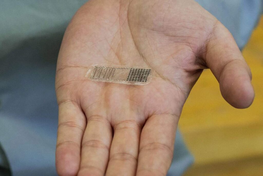 Des implants biodégradables à base de zinc pour le traitement des fractures