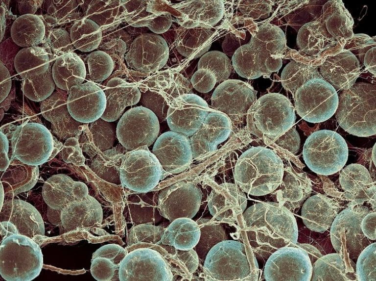 Des scientifiques font une découverte aidant à déchiffrer les tissus adipeux