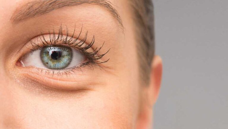 Les origines des poches sous les yeux et leurs remèdes