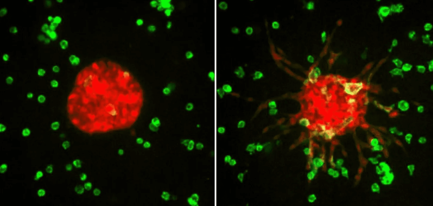 Résoudre l'énigme de la force des cellules cancéreuses
