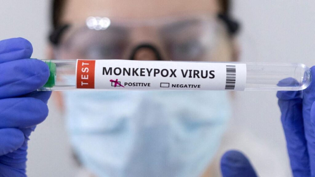 Alerte maximale concernant la variole du singe !
