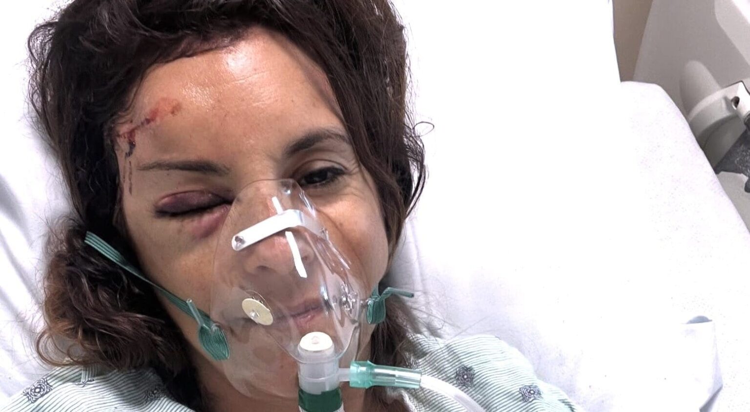 Marion Jolles Grosjean accident de velo