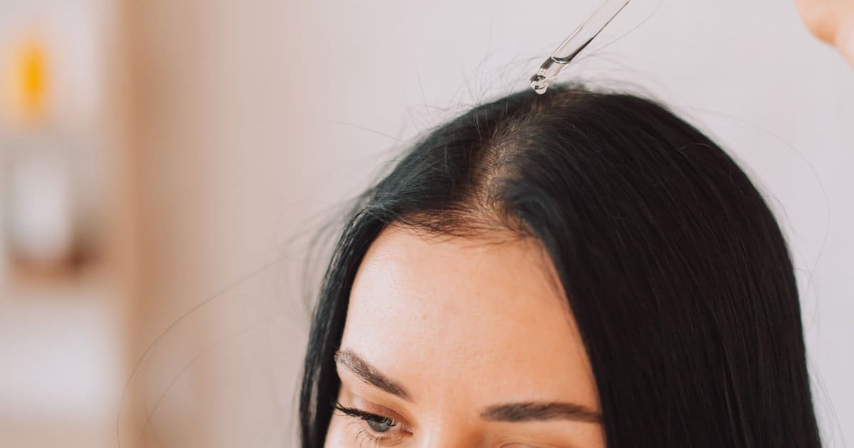 SANTÉ - Des huiles végétales pour se débarrasser des pellicules