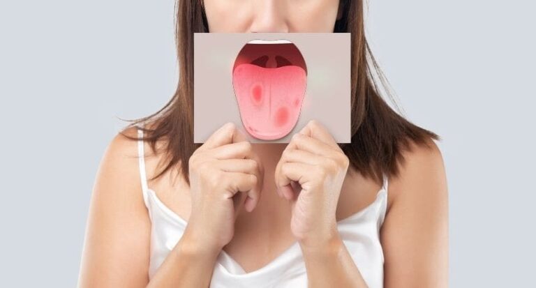 Un dentiste alerte sur les effets négatifs de la cigarette électronique sur la langue