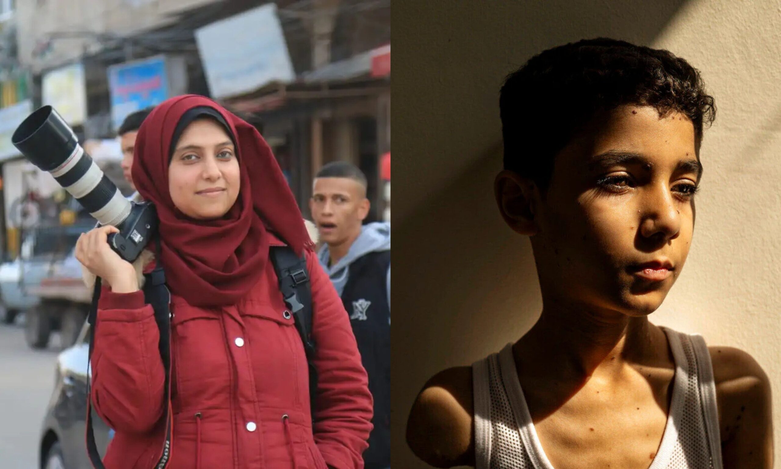 World Press Photo 2025 : le portrait d’un enfant amputé à Gaza remporte le premier prix