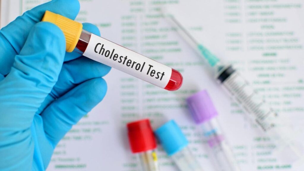 Quand le bon cholestérol devient nocif