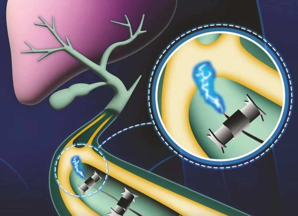 Une fiction scientifique qui devient réalité.. Des robots miniatures pour délivrer des médicaments dans le corps humain