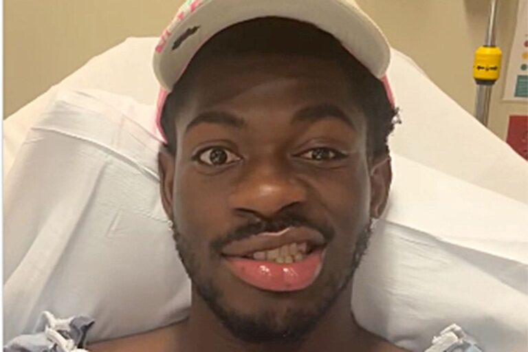 Lil Nas X victime d’une paralysie faciale : "J’ai l’air d’un fou d’un côté"