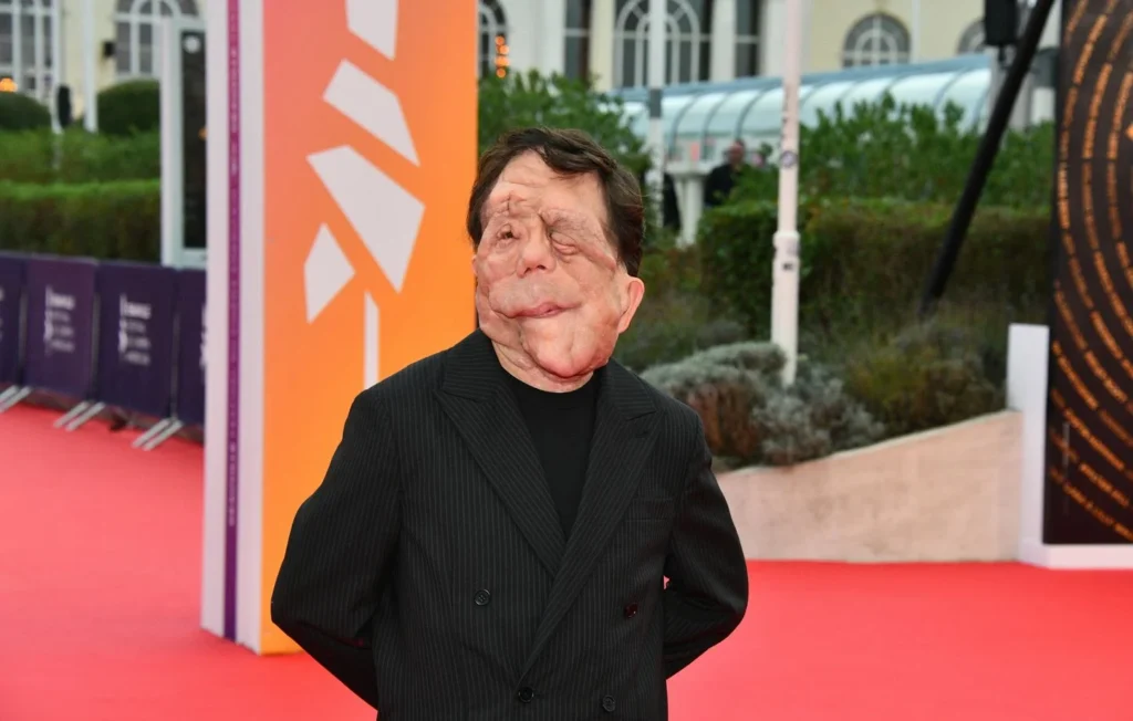 Adam Pearson incarnera “Elephant Man” : un rôle hautement symbolique pour l’acteur militant