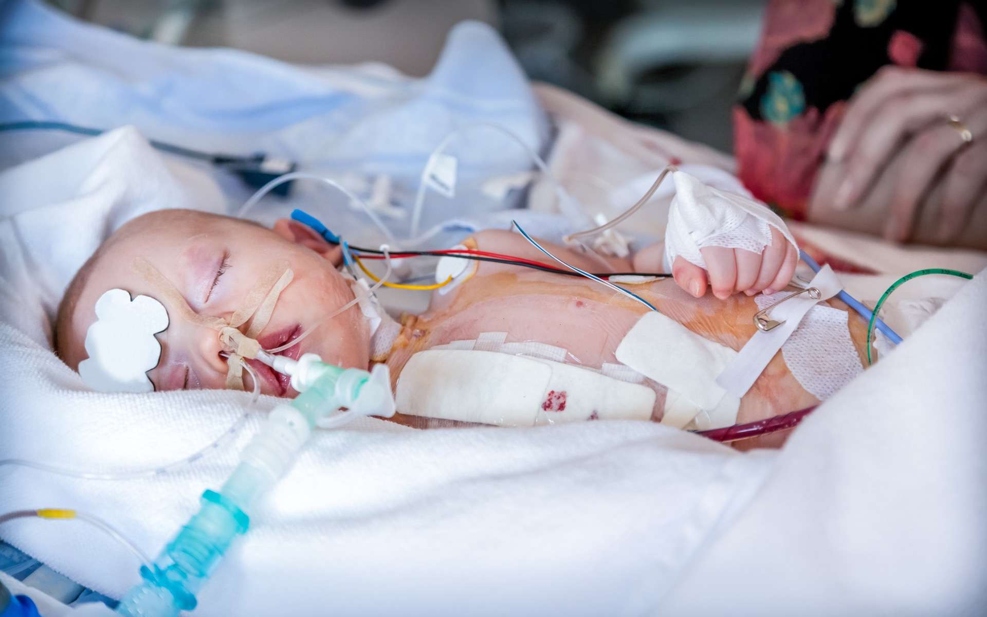 Mortalité infantile : pourquoi la France décroche face à l’Europe