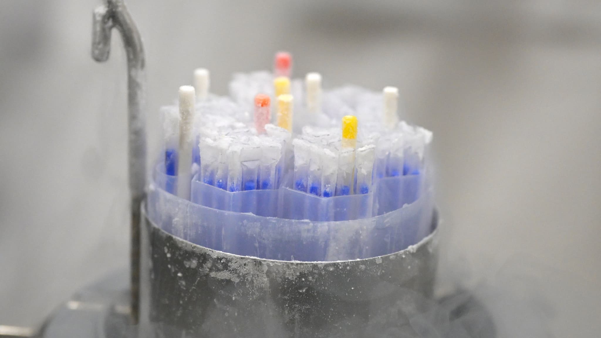 Don de sperme : des cancers précoces chez plusieurs enfants en Europe