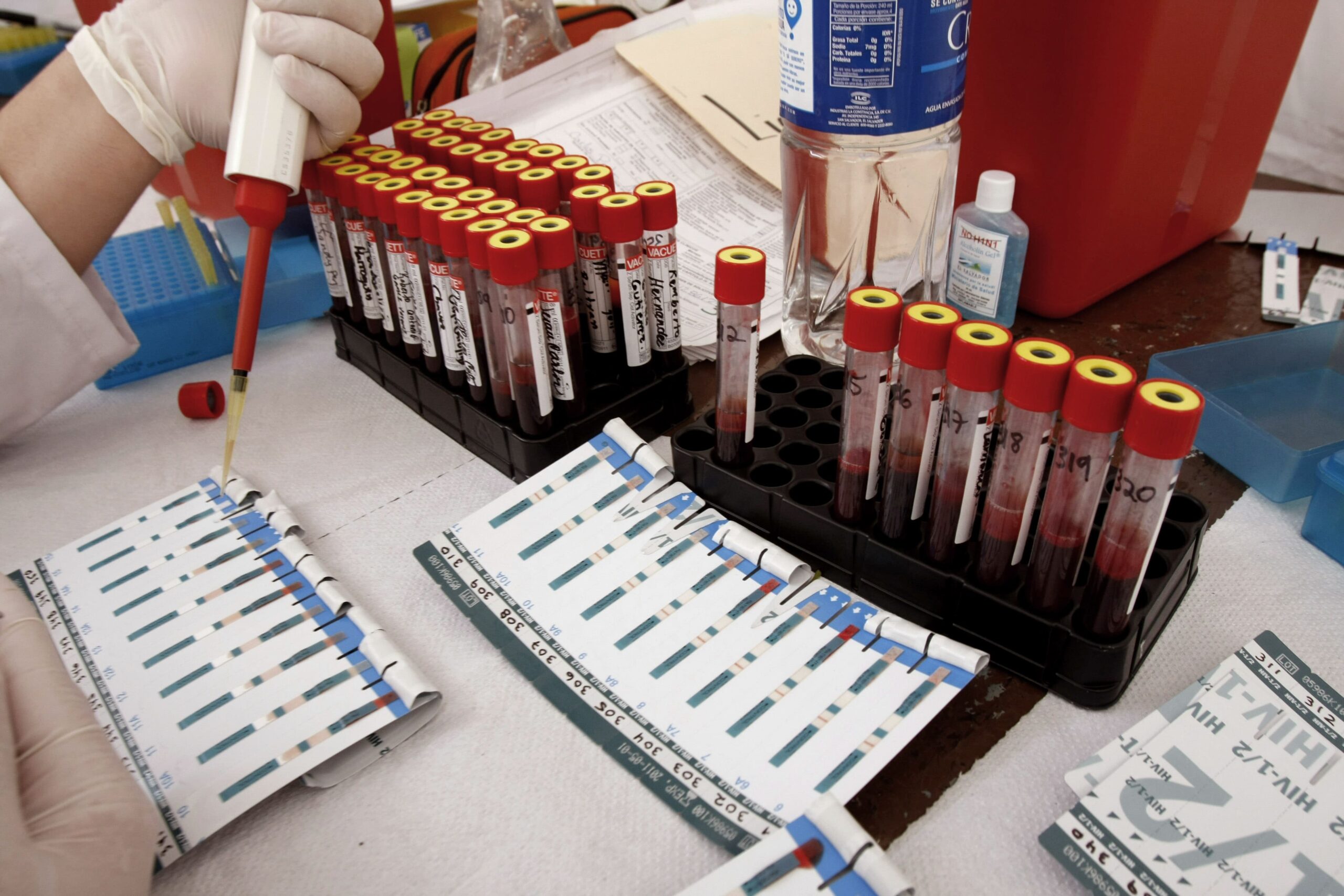 SANTÉ - Le Japon élabore un sang artificiel universel. Une véritable révolution !