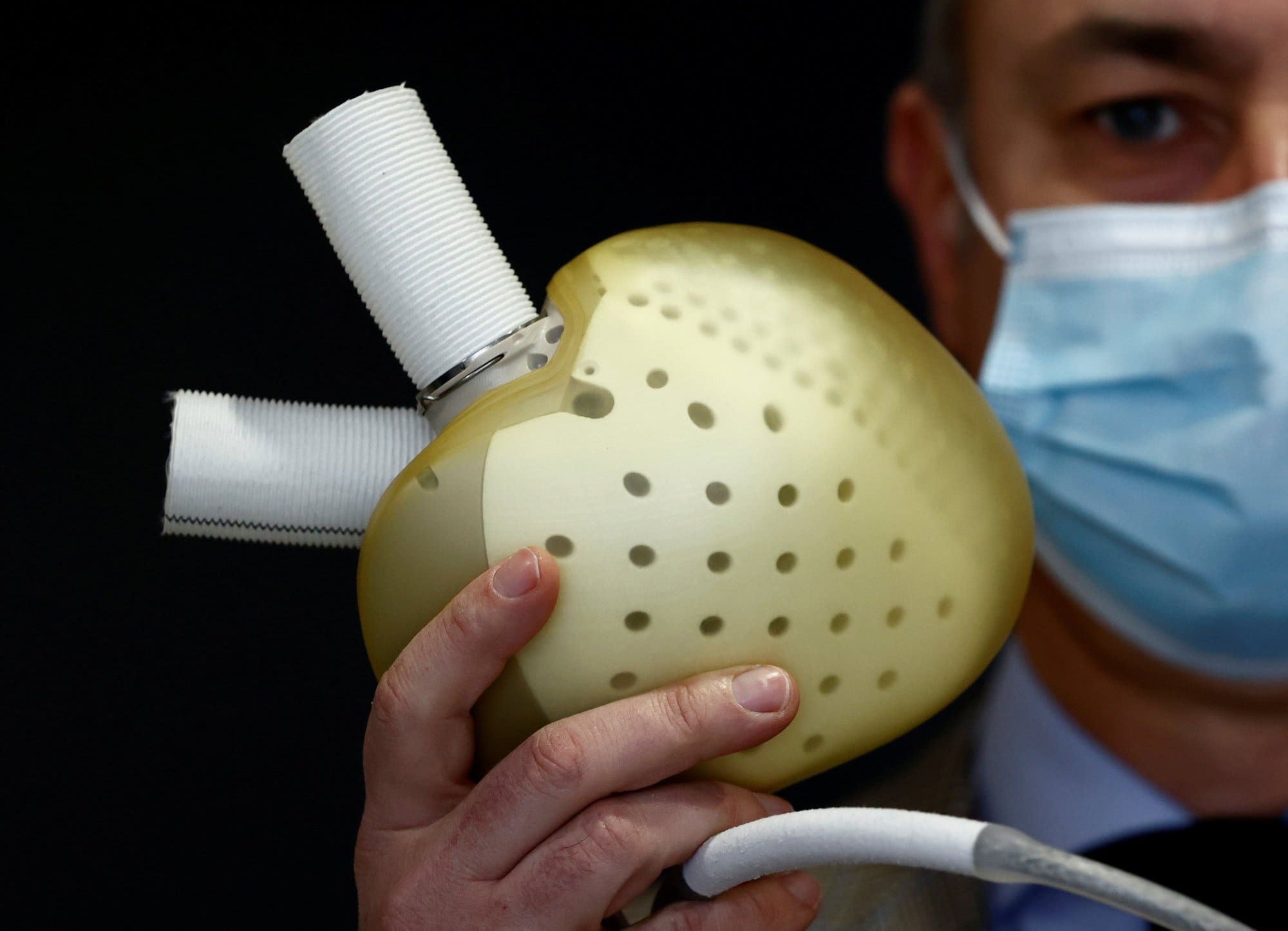 Fleuron de la haute technologie médicale, Carmat au bord du gouffre financier 