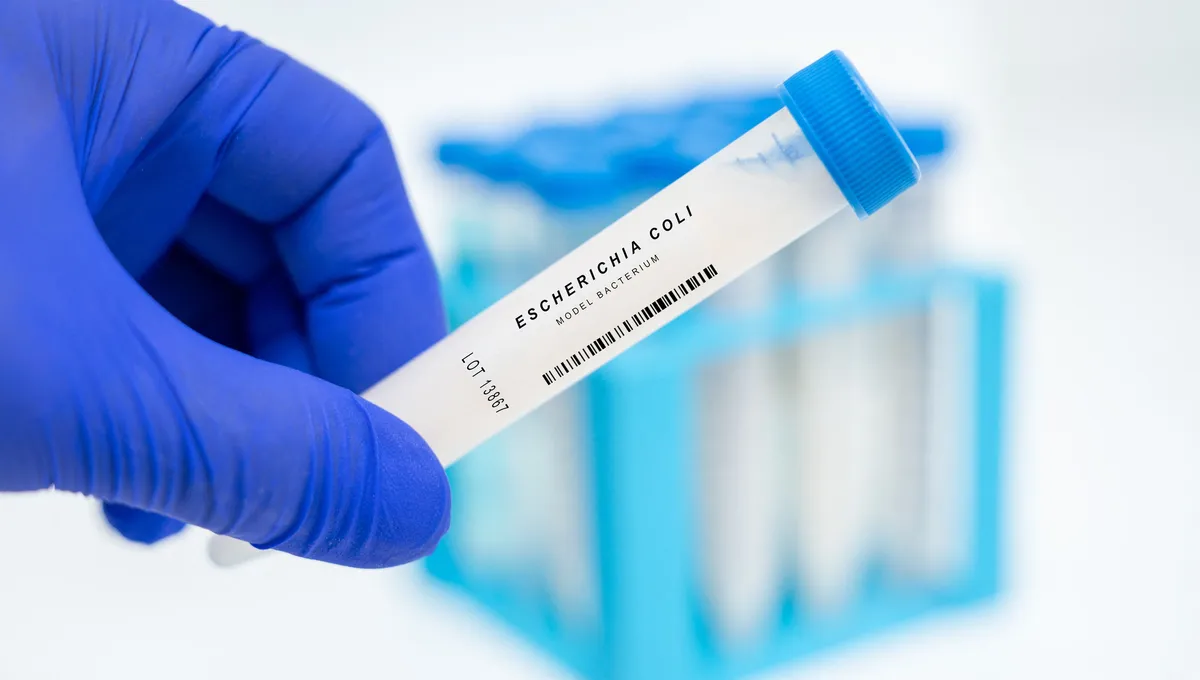 Vague d’intoxications à la bactérie E. coli : désormais 25 cas recensés