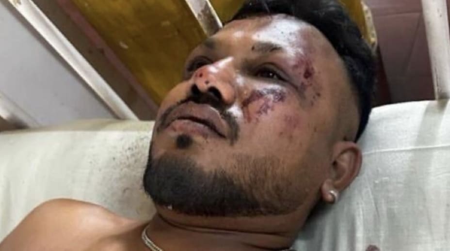 Crash d’Air India, le miraculé témoigne: «C’est arrivé si vite. Quand j’ai repris conscience, il y avait des corps autour de moi. J’étais effrayé.»