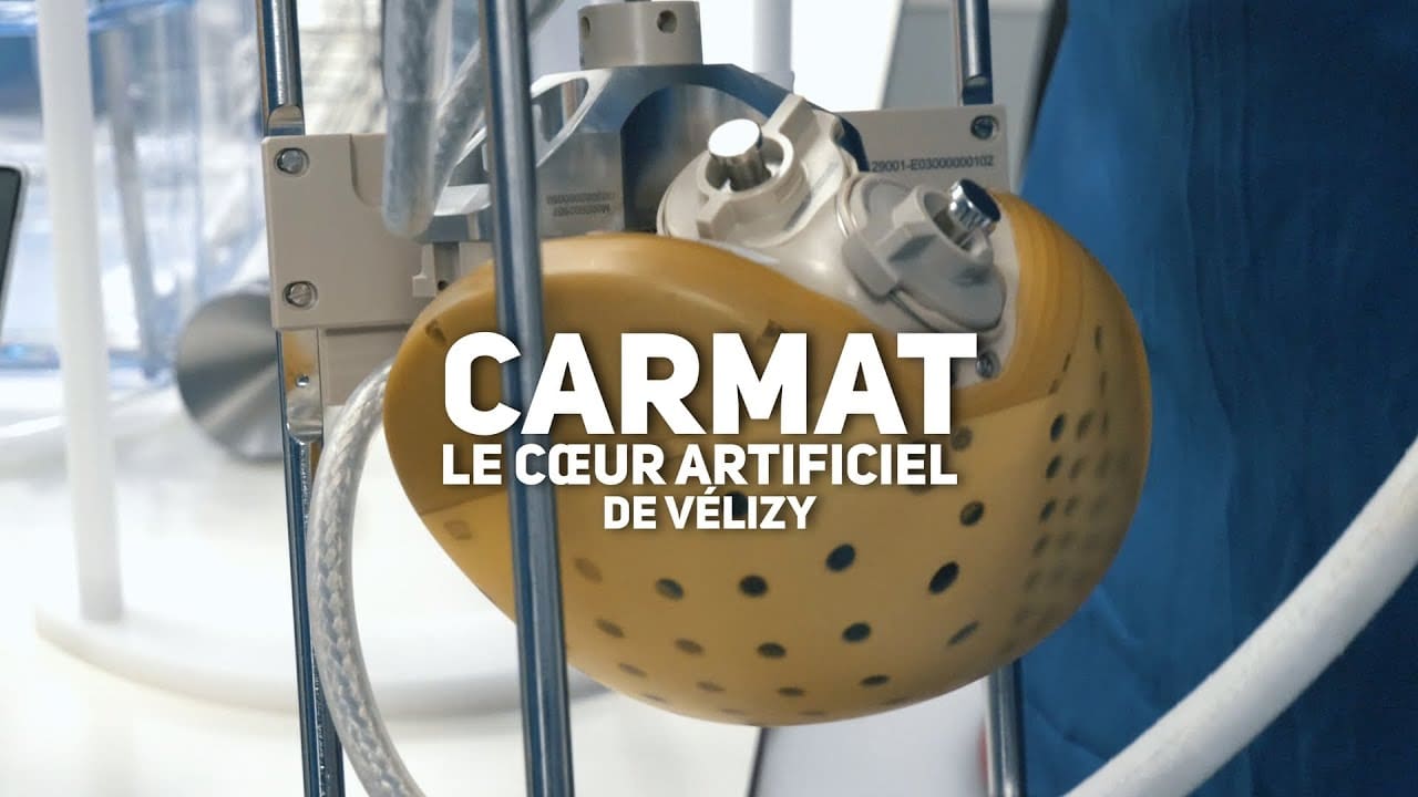 Carmat le pionnier du cœur artificiel en faillite après 550 millions d’euros engloutis