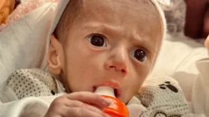 Gaza : une mère supplie pour l’évacuation urgente de sa fille atteinte de malnutrition