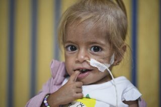 Une fillette évacuée de Gaza pour une maladie rare reprend du poids dans un hôpital italien @AP