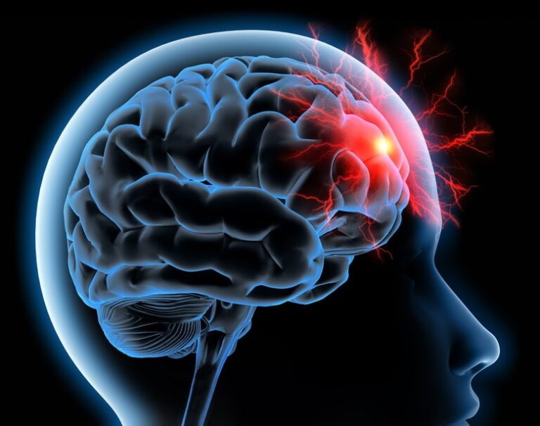 Reconnaître un AVC grâce à un moyen simple