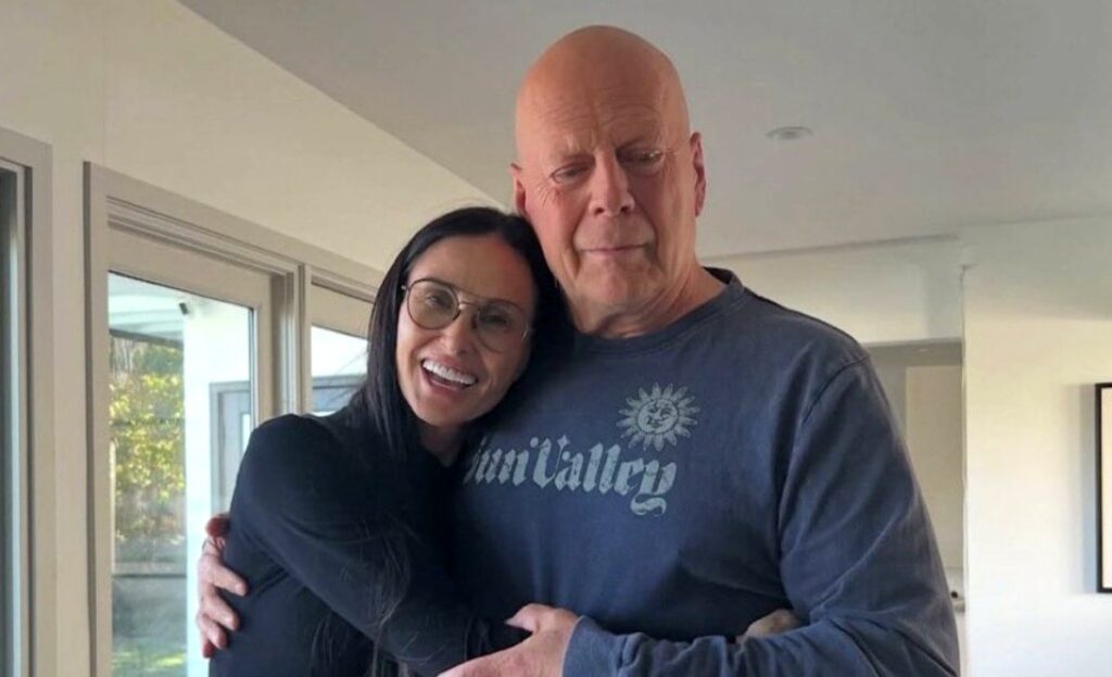 Bruce Willis : sa famille annonce qu'elle donnera son cerveau à la médecine après sa mort pour aider la recherche sur la démence. (DR)