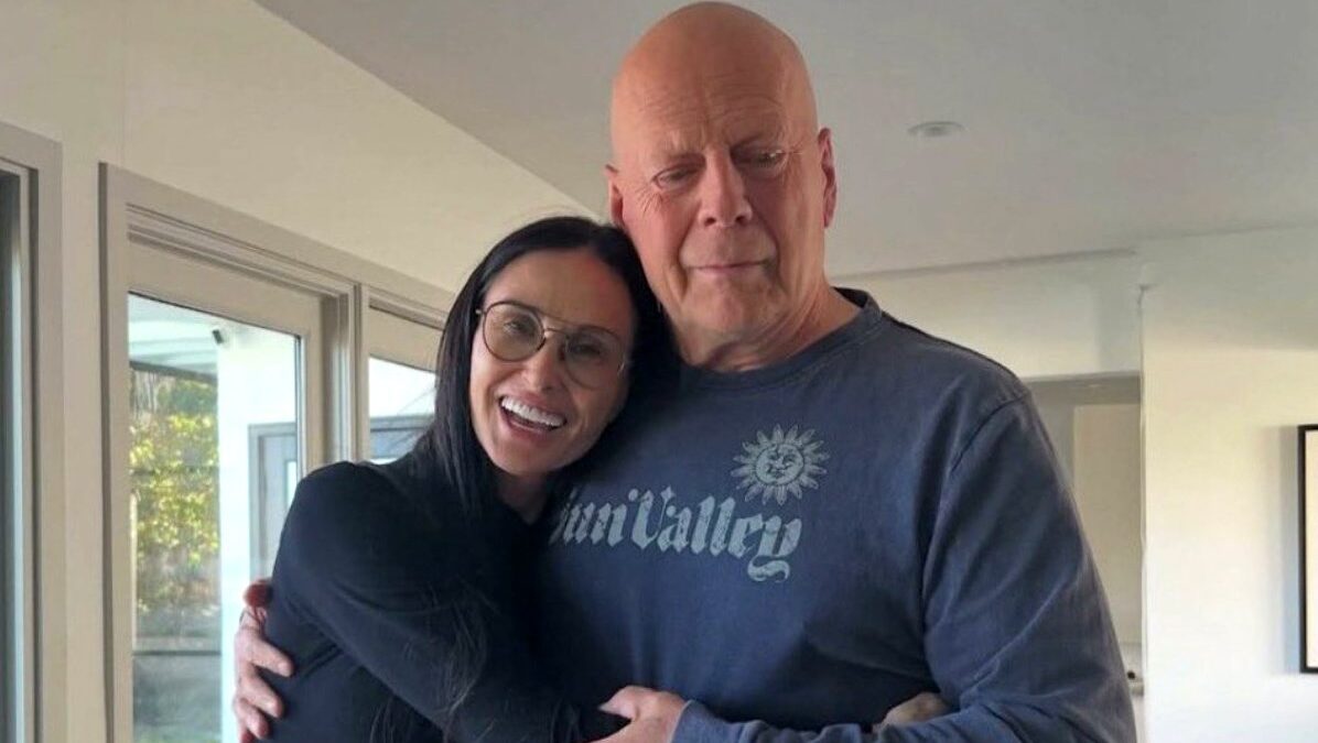 Bruce Willis : sa famille annonce qu'elle donnera son cerveau à la médecine après sa mort pour aider la recherche sur la démence. (DR)