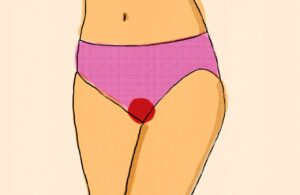 Puberté précoce - pourquoi les jeunes filles ont leurs règles de plus en plus tôt