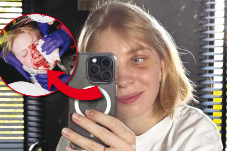 Malgré une plaque de titane dans l'orbite, la patineuse Kamila Sellier, gravement blessée aux JO, veut relancer sa carrière