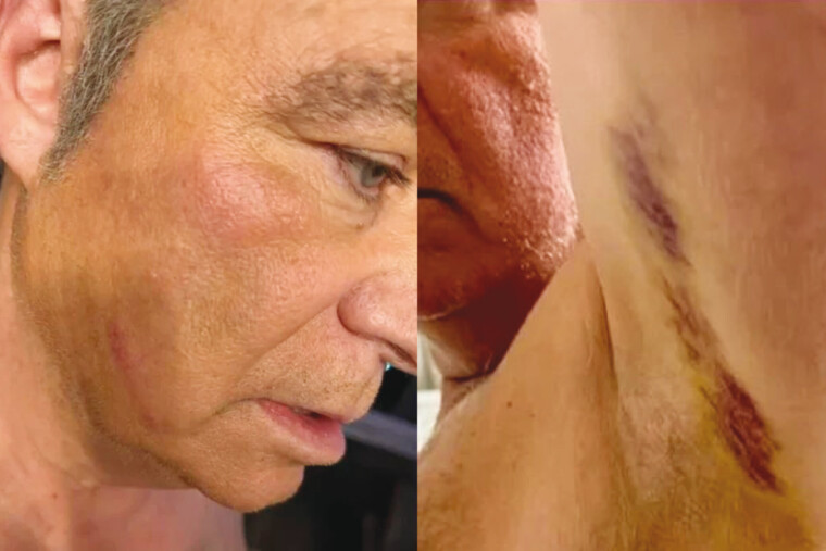 SCOOP - «Volonté de tuer, hématome, nausées, maux de têtes, perte d’équilibre...» Tous les détails sur l'agression de Fabien Lecœuvre