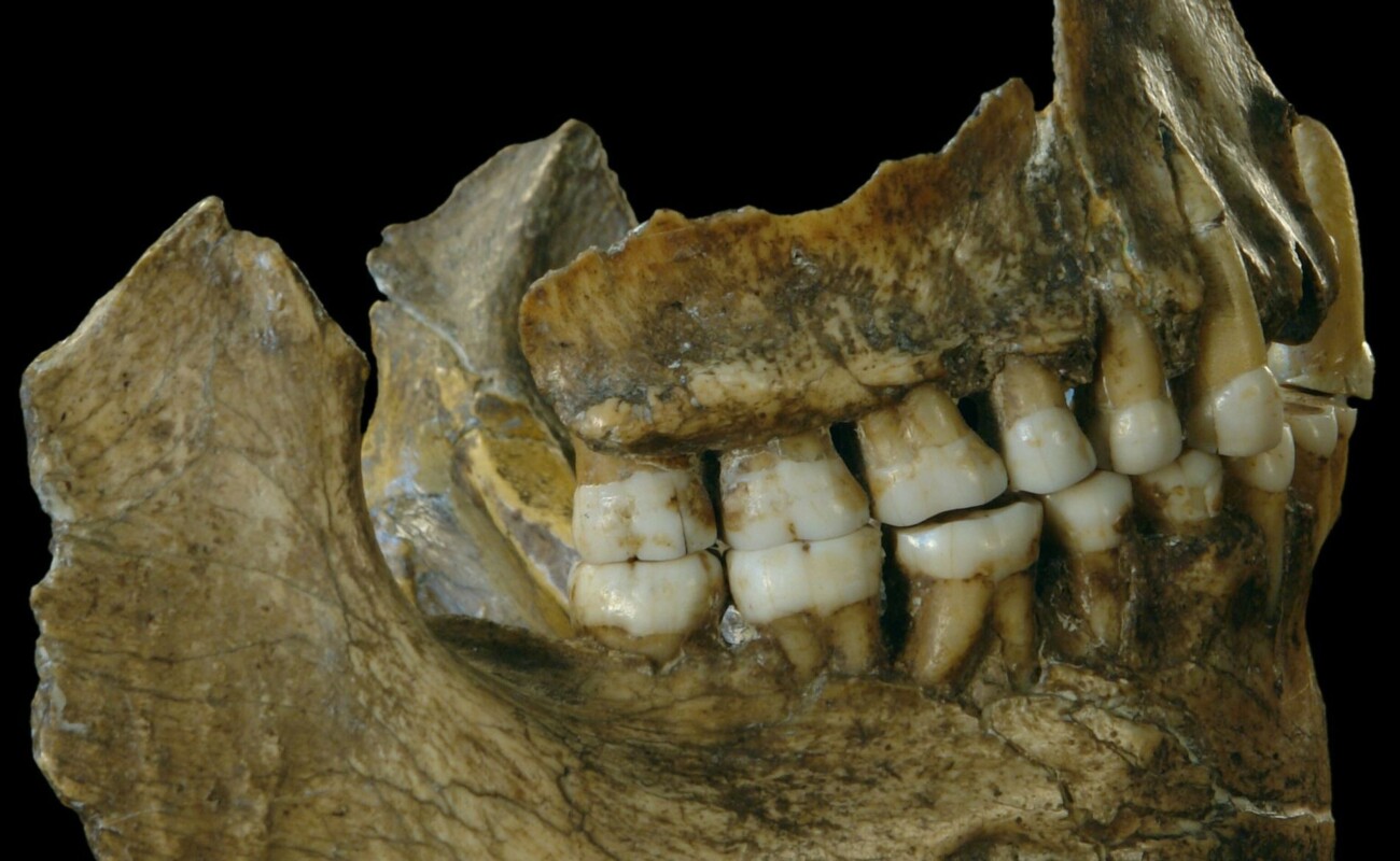 Neanderthal, il primo dentista: una carie curata 60.000 anni fa