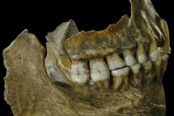 Néandertal, premier dentiste : une carie soignée il y a 60 000 ans