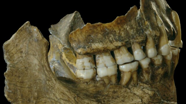 Néandertal, premier dentiste : une carie soignée il y a 60 000 ans Néandertal, premier dentiste : une carie soignée il y a 60 000 ans