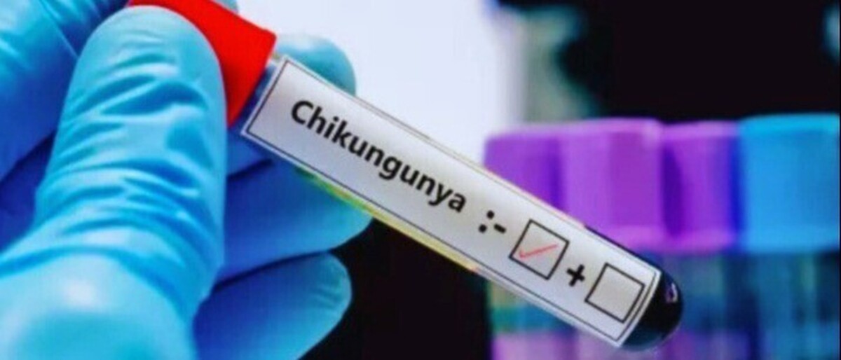 French Guiana: A vaccination campaign launched in response to the spread of chikungunya
