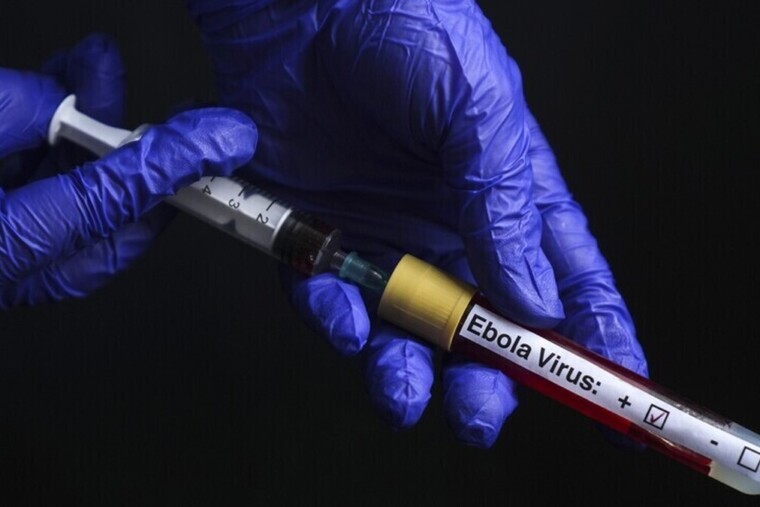 Un médecin américain guéri d’Ebola après un traitement en Allemagne
