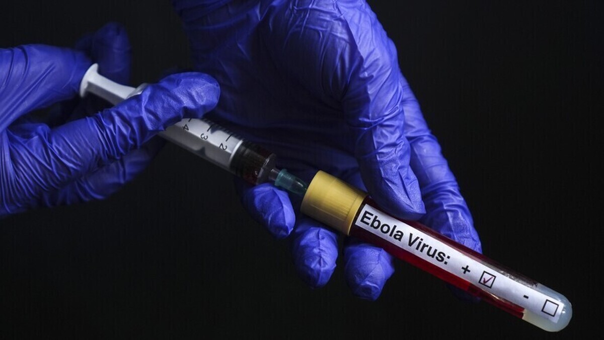 An American doctor cured of Ebola after treatment in Germany