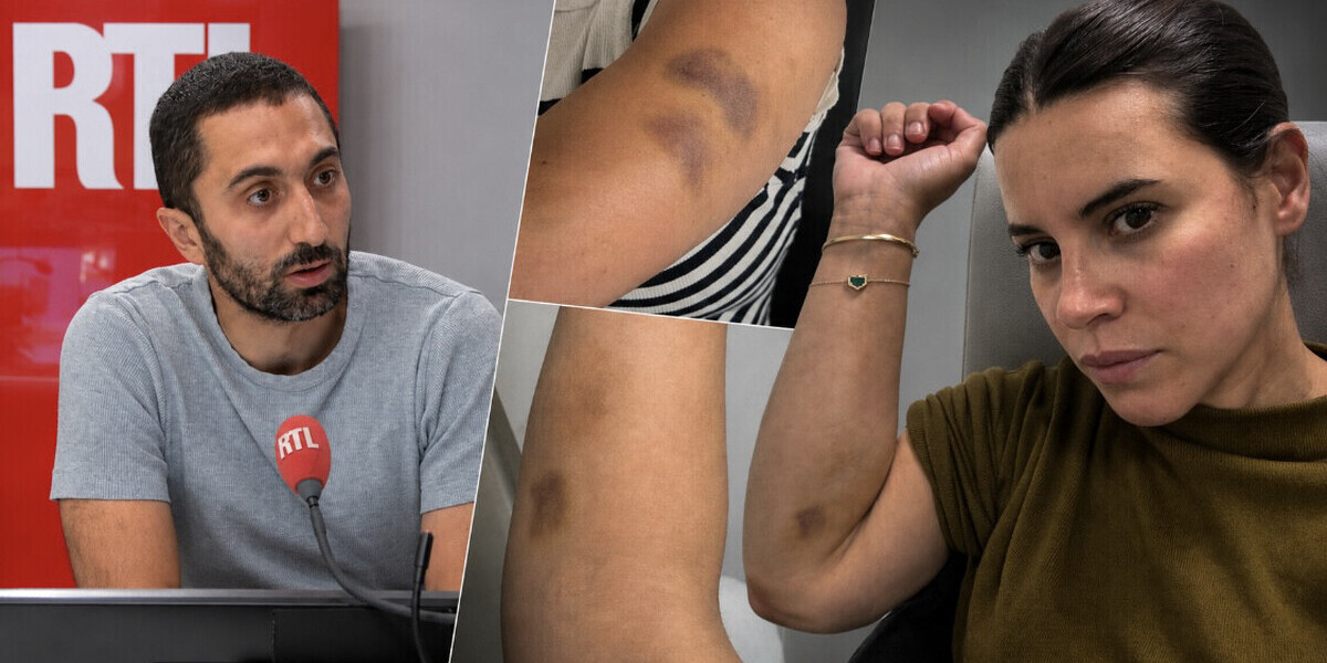 Jimmy Mohamed : son épouse l’accuse de violences conjugales et diffuse des photos d’ecchymoses