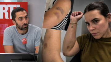 Jimmy Mohamed : son épouse l’accuse de violences conjugales et diffuse des photos d’ecchymoses