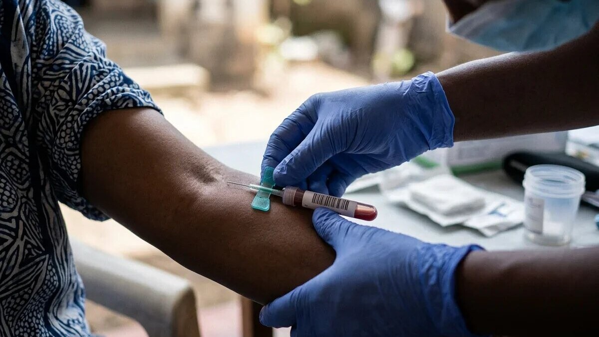 Mayotte : 85 % des adultes immunisés contre la rougeole, un seuil insuffisant