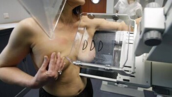 Cancer du sein : le dépistage manquerait 95 % des femmes à risque avant 50 ans en Angleterre