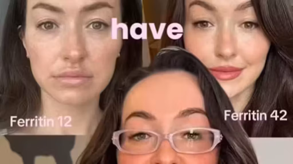 « Ferritin face » : sur TikTok, le visage devient un faux outil de diagnostic médical