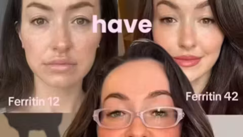 « Ferritin face » : sur TikTok, le visage devient un faux outil de diagnostic médical